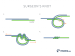 Surgeons Knot